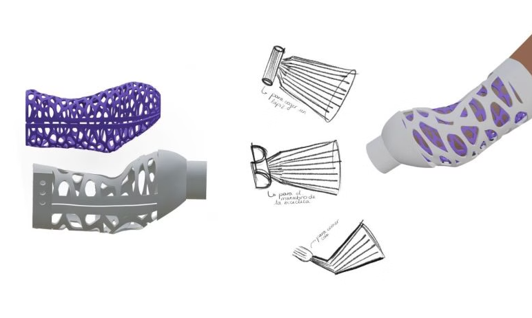 Encaja: 3D nyomtatható protézistok nyert Dyson-díjat